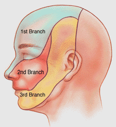 trigeminal nerve branches .gif